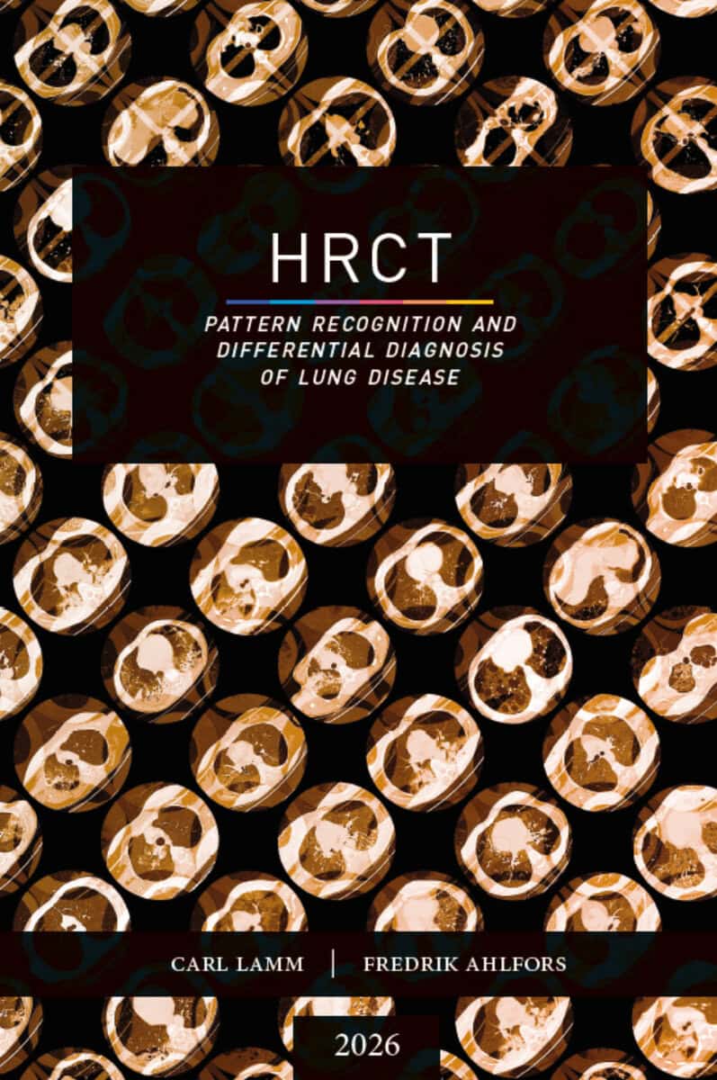 Ahlfors, Fredrik ; Lamm, Carl : HRCT - Pattern Recognition and Differential Diagnosis of Lung Disease