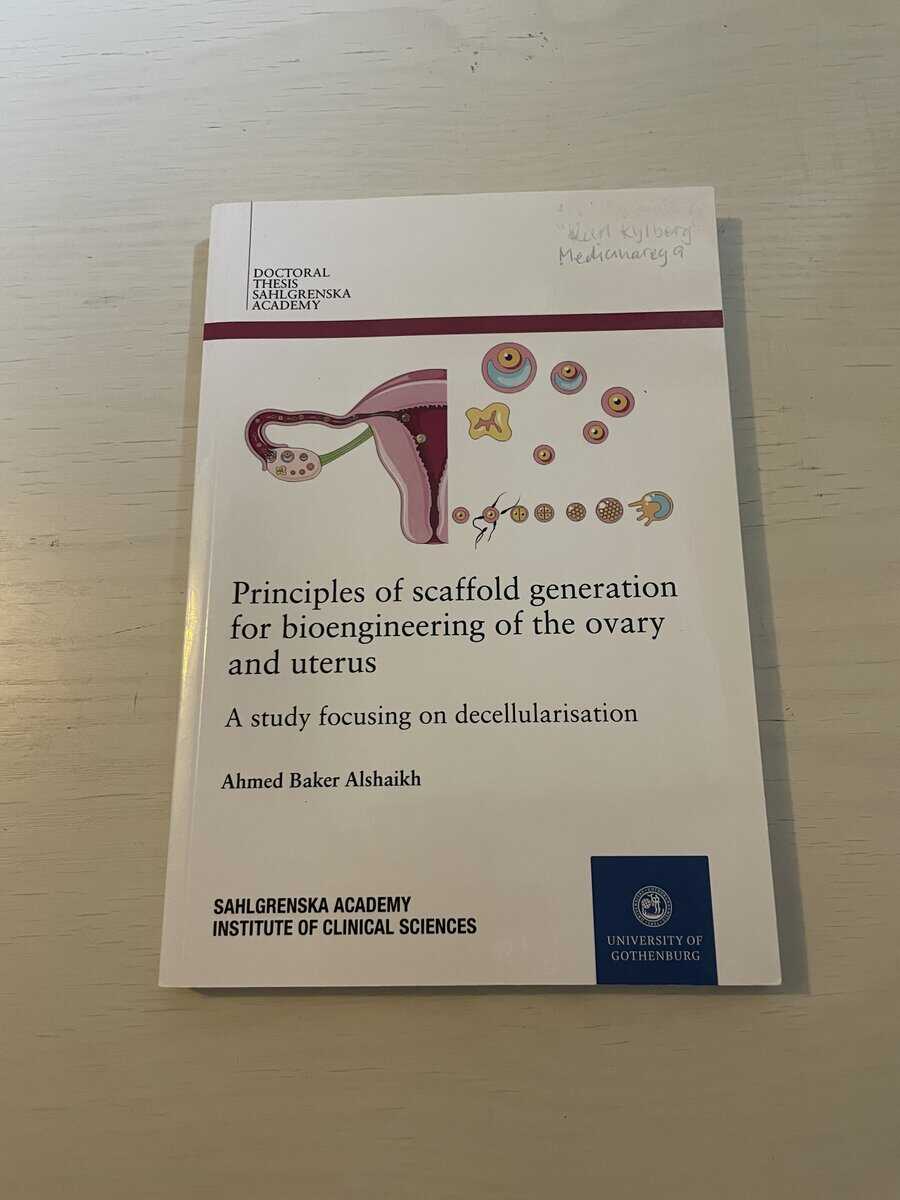 Ahmed Baker Alshaikh : Principles of scaffold generation for bioengineering of the ovary and uterus