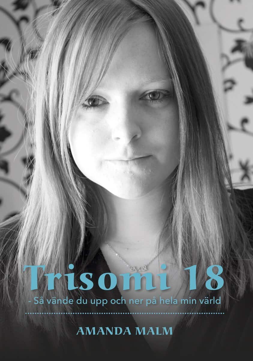 Amanda Malm : Trisomi 18 : så vände du upp och ner på hela min värld