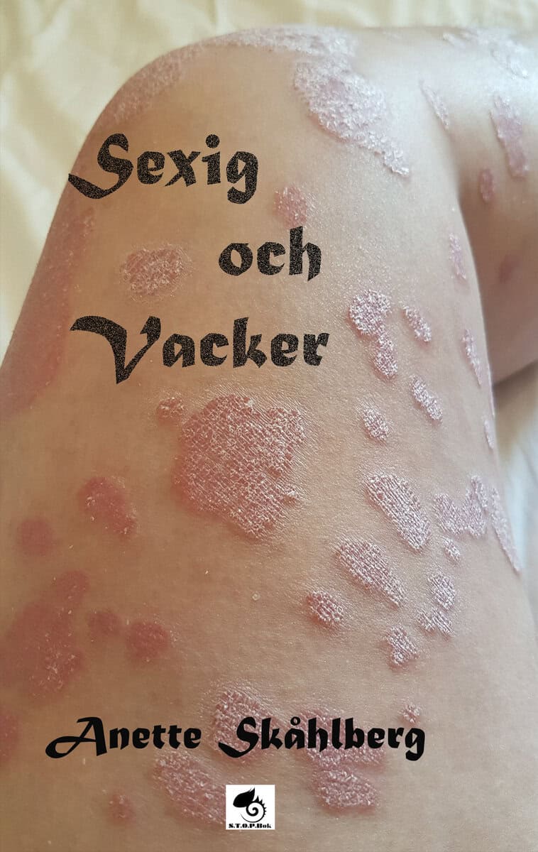 Anette Skåhlberg : Sexig och Vacker