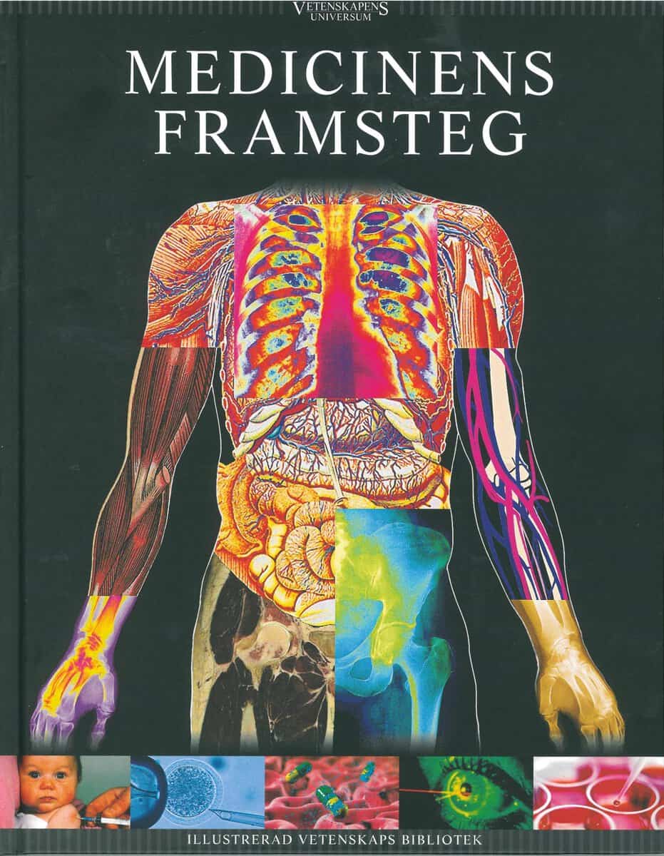 Christiansen, Jacob ; Enevold, Anders ; Foghsgaard, Lasse ; Hansen, Anne ; Palmgren, Gorm ; Stentoft, Stine : Vetenskapens universum. Medicinens framsteg