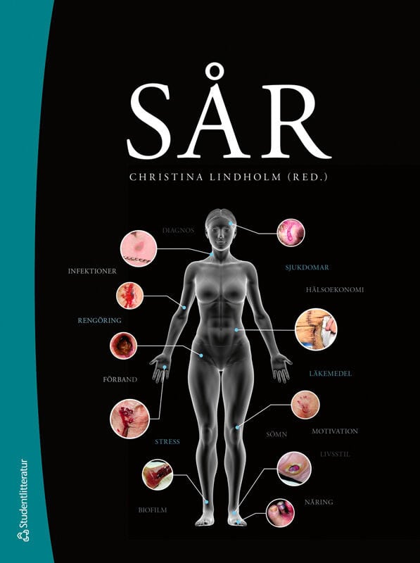 Lindholm, Christina ; Andersson, Hanna ; Andersson Forsström, Helene ; Bååth, Carina ; Dufva, Susanne ; Karlsson, Matilda ; Källman, Ulrika ; Munter, Malin ; Sahlberg, Liselott : Sår