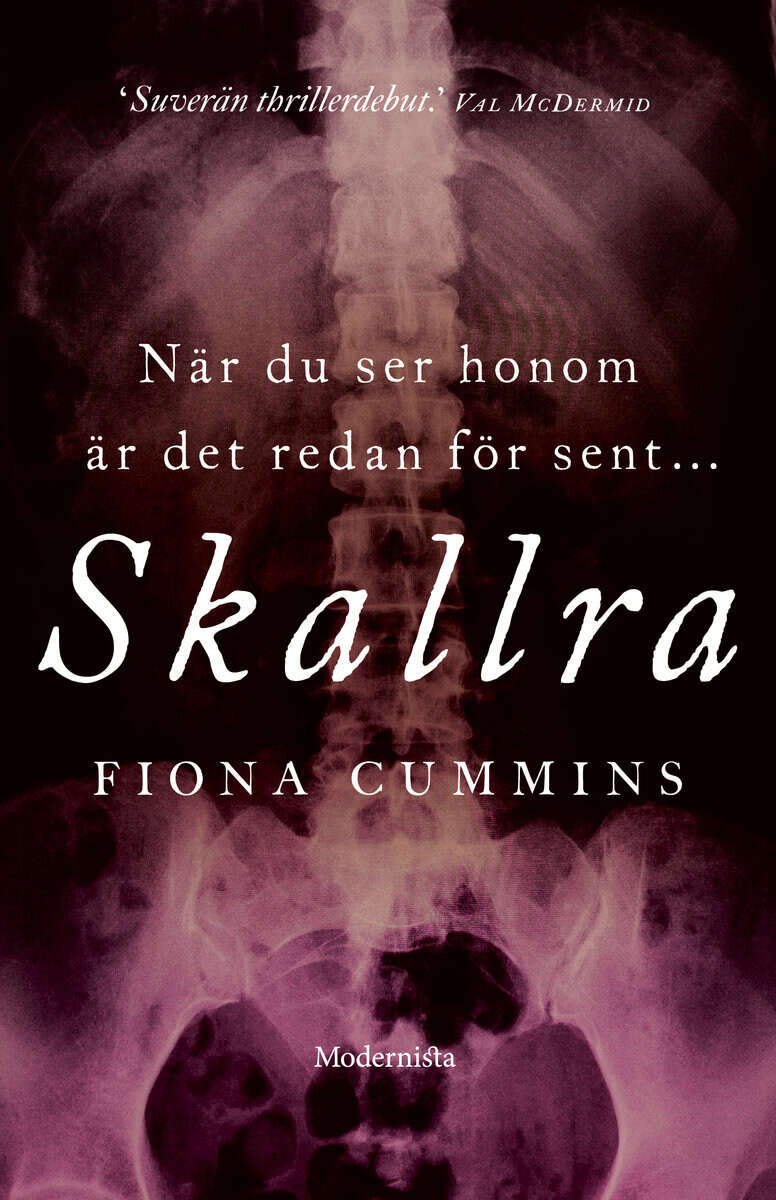 Fiona Cummins : Skallra