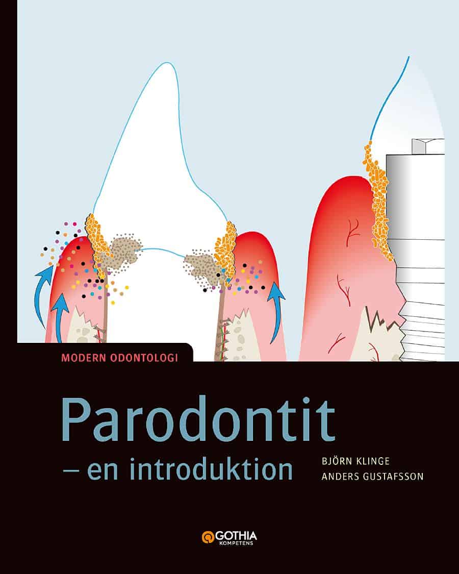 Gustafsson, Anders ; Klinge, Björn : Parodontit : en introduktion