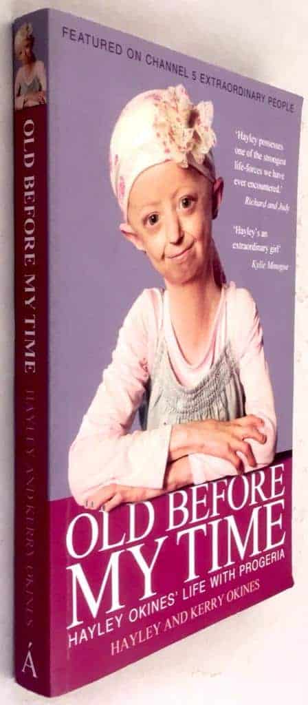 Hayley Okines : Old before my time - Hayley Okines' life with progeria