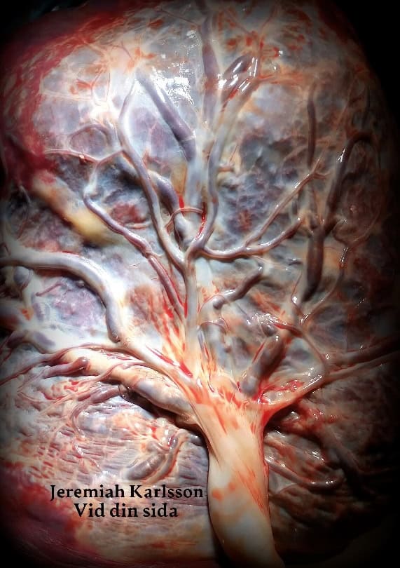 Jeremiah Karlsson : Vid din sida