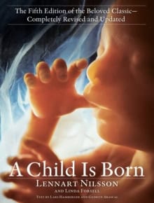 Lennart Nilsson : A Child Is Born