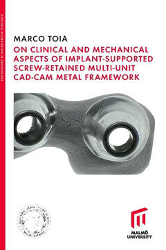 Marco Toia : On Clinical and Mechanical Aspects of Implant-Supported Screw-Retained Multi-Unit CAD-CAM Metal Framework