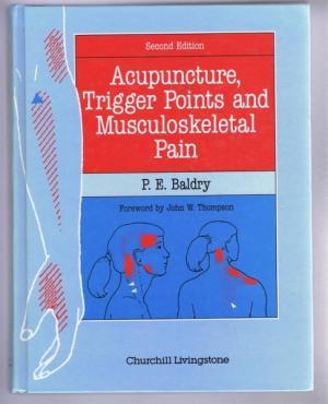 P. E. Baldry : Acupuncture, trigger points and musculoskeletal pain