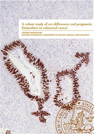 Sakarias Wangefjord : A cohort study of sex differences and prognostic biomarkers in colerctal cancer