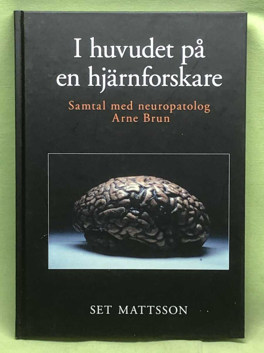 Set Matsson : I huvudet på en hjärnforskare