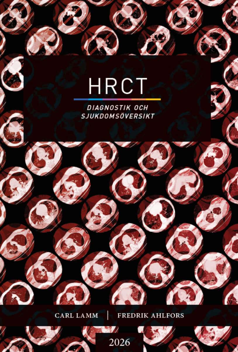 Ahlfors, Fredrik ; Lamm, Carl : HRCT - Diagnostik och sjukdomsöversikt