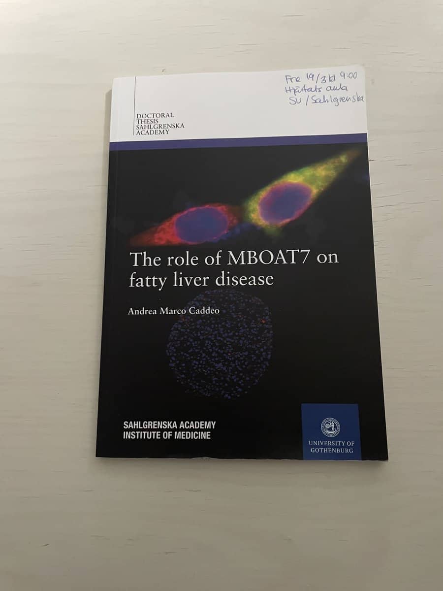 Andrea Marco Caddeo : The role of MBOAT7 on fatty liver disease