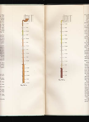 Erik Karlmark : En hjälpmetod för bestämmande av tidpunkten, när döden inträtt. (Eine Hilfsmethodik zur Feststellung von der Todeszeit eines Verstorbenen. Deutsche Zusammenfassung