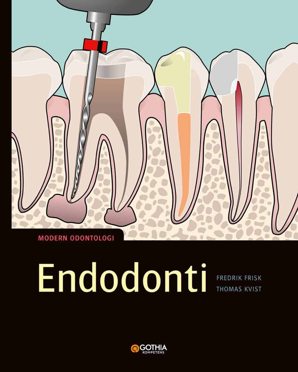 Frisk, Fredrik ; Kvist, Thomas : Endodonti