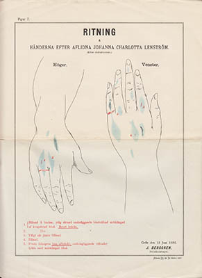 Handlingar rörande Norbergska målet. I. Rättegångshandlingar från Rådhusrätten i Gefle. II. Yttrande af medicinska fakulteten i Lund