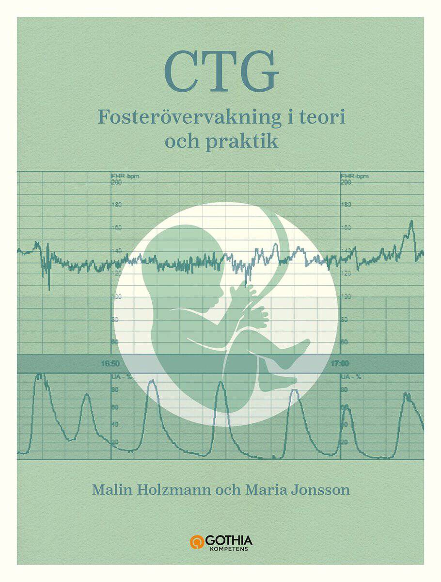 Holzmann, Malin ; Jonsson, Maria : CTG : fosterövervakning i teori och praktik