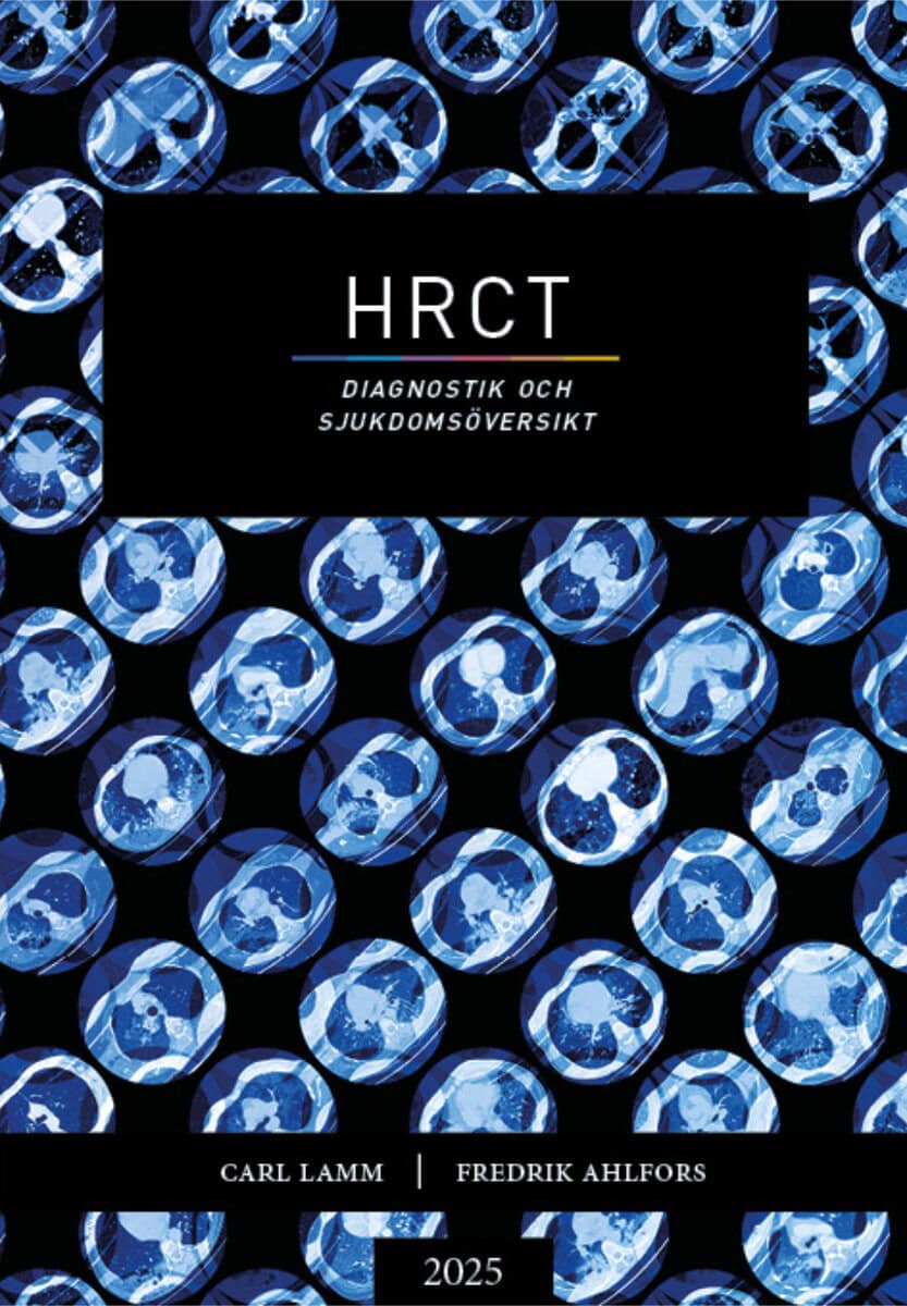 Lamm, Carl ; Ahlfors, Fredrik : HRCT : diagnostik och sjukdomsöversikt