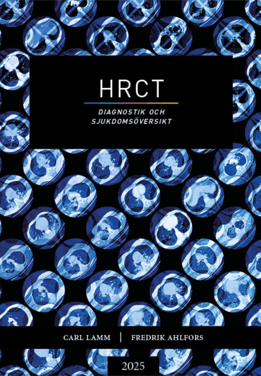 Lamm, Carl ; Ahlfors, Fredrik : HRCT : diagnostik och sjukdomsöversikt