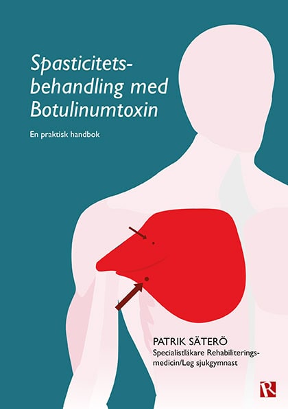 Patrik Säterö : Spasticitetsbehandling med Botulinumtoxin : en praktisk handbok