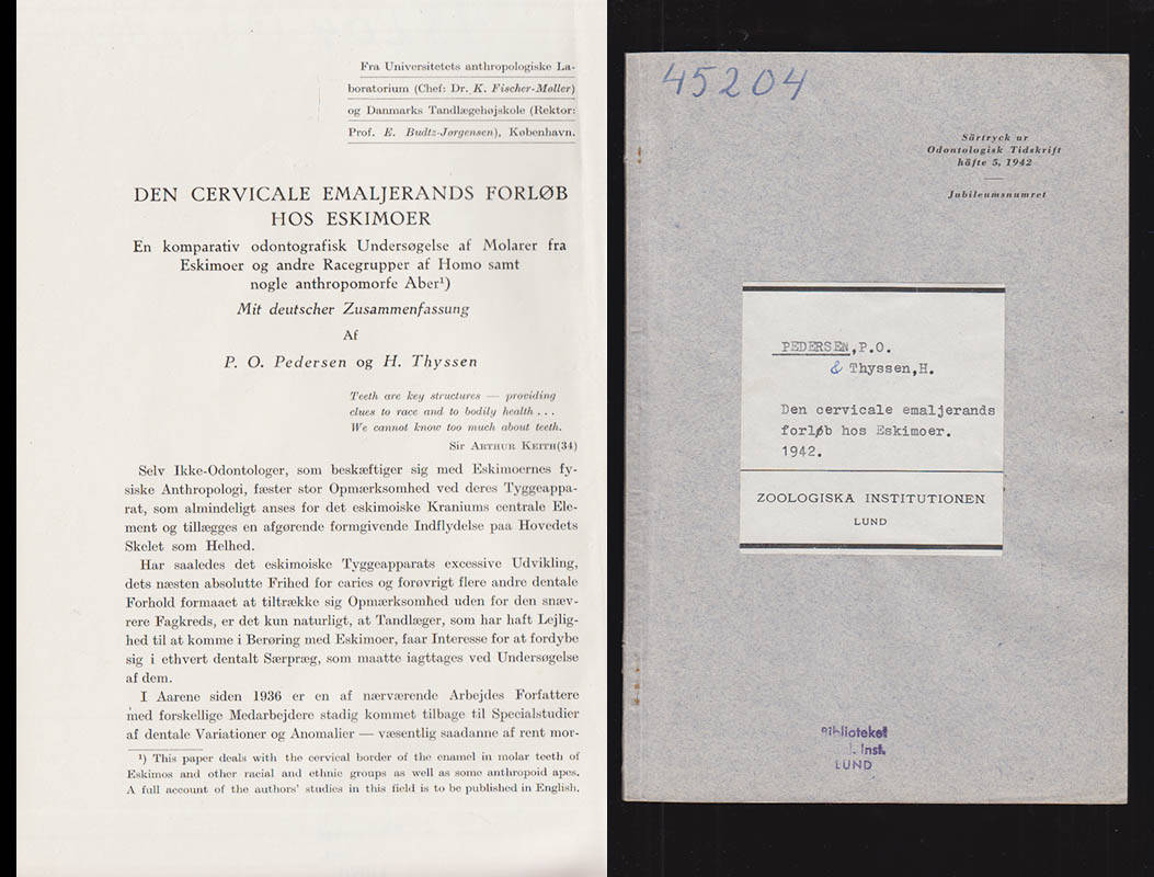 Pedersen, P. O. ; Thyssen, H. : Den cervicale emaljerands forløb hos eskimoer. En komparativ odontografisk undersøgelse af molarer fra eskimoer og andre racegrupper af homo samt nogle anthropomorfe aber