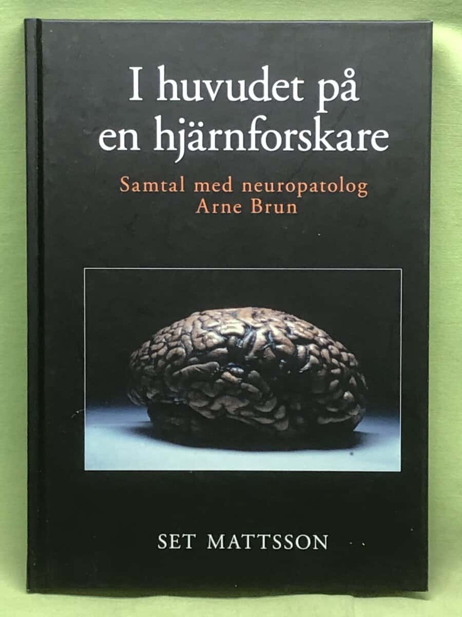 Set Matsson : I huvudet på en hjärnforskare