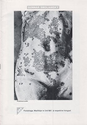 Smoliansky, Gunnar, med flera : Fotobilaga. Medföljer nr 3-4/ 1981 © rspektive fotograf